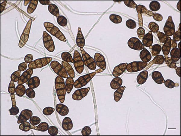 Guía definitiva para eliminar Alternaria de tus plantas: ¡Descubre el secreto!